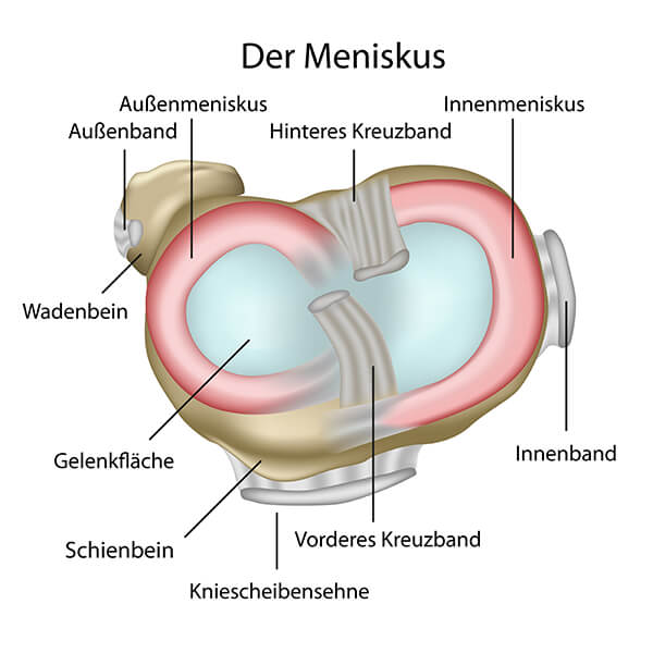 Der Meniskus